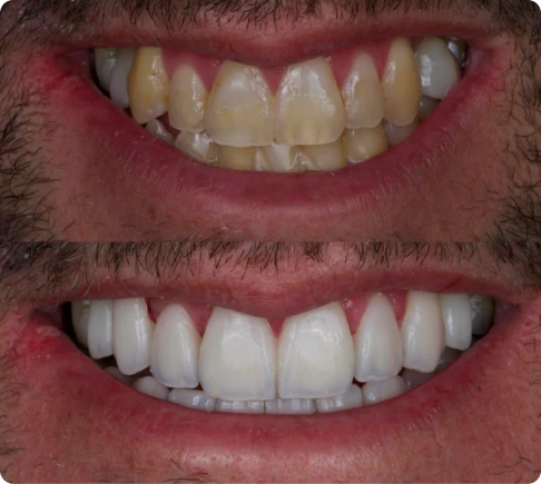 Cas 2