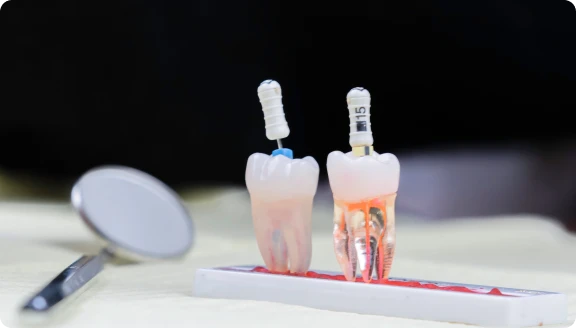Endodontie