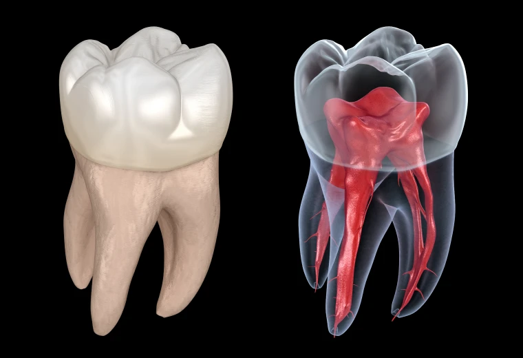 Illustration 3D de l'anatomie complexe des canaux radiculaires d'une dent