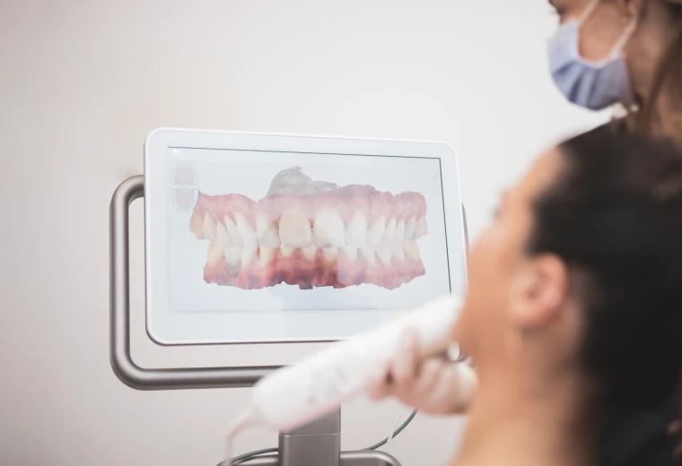 Écran affichant la planification numérique 3D d'un traitement par aligneurs invisibles