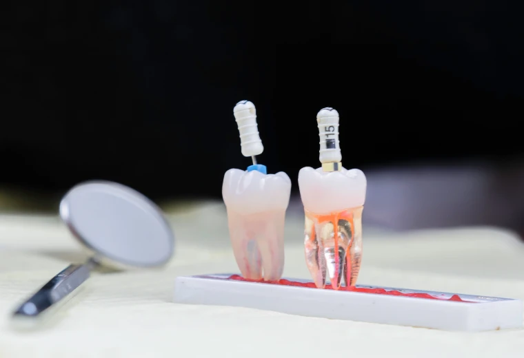 Modèle démonstratif de résection apicale sur extrémité de racine dentaire